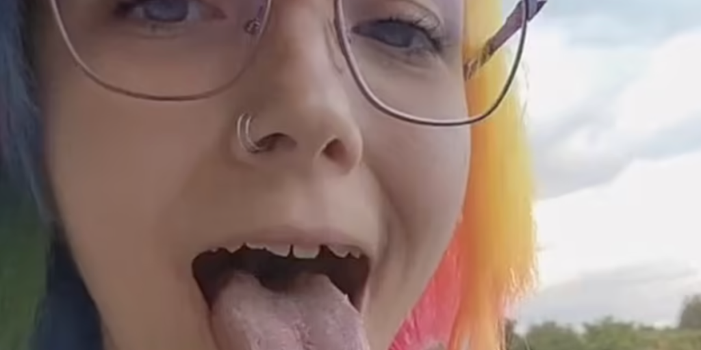 Ung kvinde har fået vild ‘kropsmodifikation’: Måtte lære at tale og spise på ny bagefter